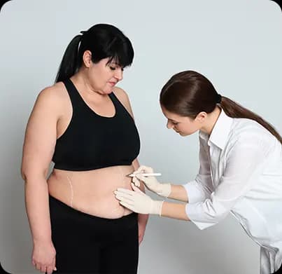 Bariatric Surgery